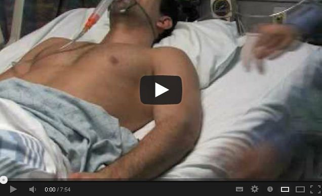 Chest Tube Insertion