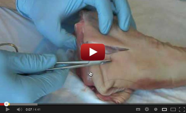 Suture - Basic Technique
