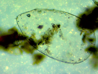 microscops large ciliate smaller.jpg