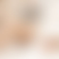 Non-Invasive Body Contouring in The Woodlands: A 2026 Buyer’s Guide