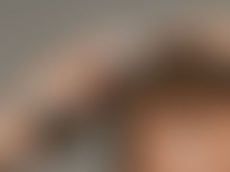 Minoxidil: What Is It and How Does It Help With Hair Loss?