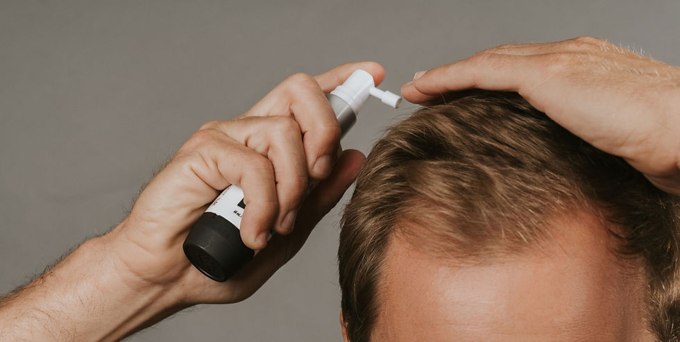 Minoxidil: What Is It and How Does It Help With Hair Loss?