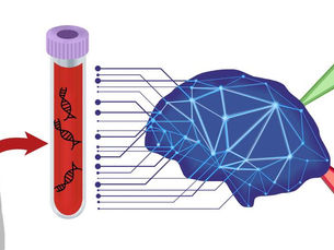 AI detects "murder" gene