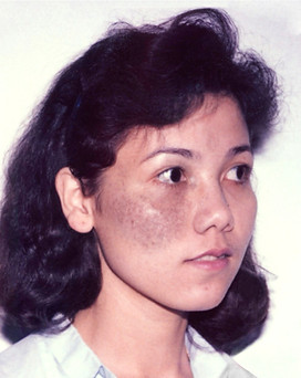Kim birthmarkAsset 1-80_edited.jpg
