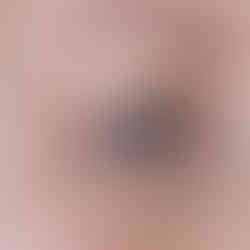 d'Alba double serum all in one multi balm applied over concealer