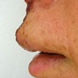 cora_lip2_side.jpg