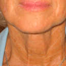 image026.gif