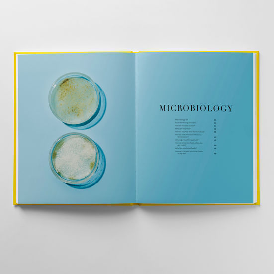 Sill-life shot overhead of 2 petri dishes containing microbes