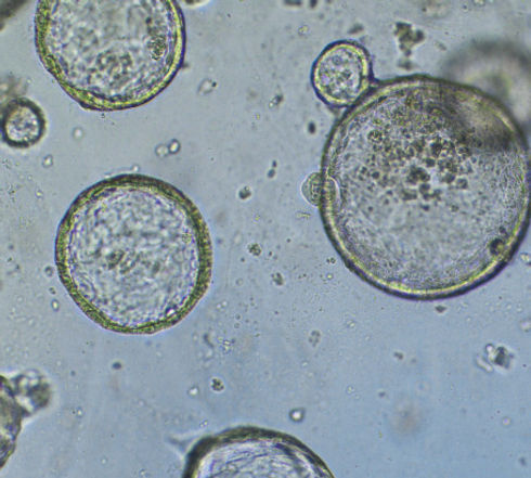 liver organoid figures for press release medium_edited.jpg