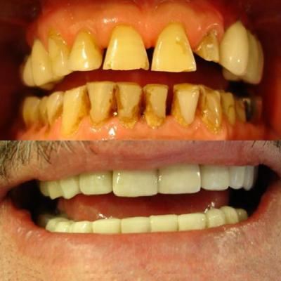 Untitled design (8).png