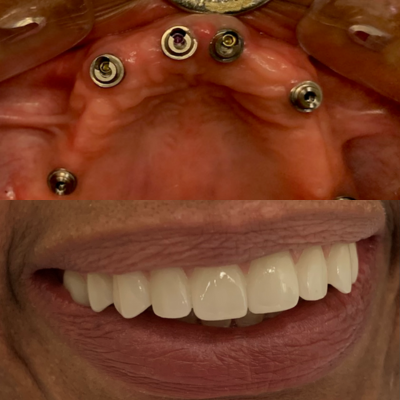 Untitled design (6).png