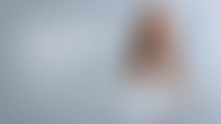 Tratamentos para pescoço e papada com o Fotona laser!