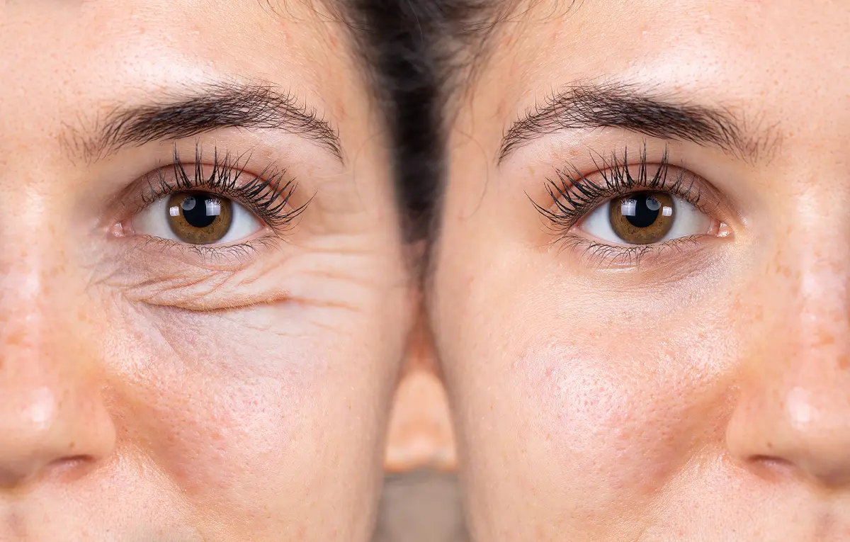 before-after-anti-aging-wrinkle-eye-cream.webp