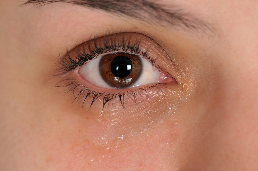 watery eyes