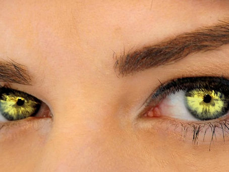 Can we tell if you have Diabetes by looking into your Eyes?