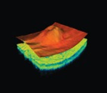 Retinal Imaging