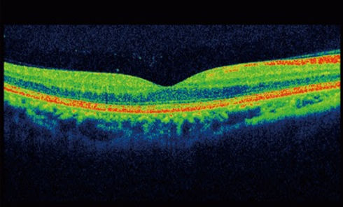 Advanced Eyecare