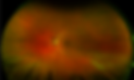 Optomap retinal image