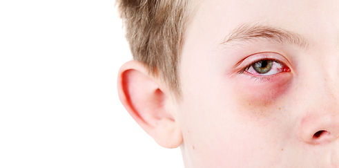 Accidents & Emergency Eye Treatment