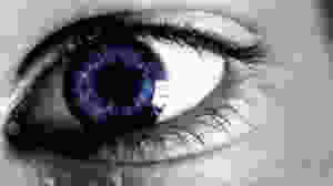 Conjunctivitis
