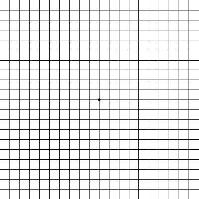 Amsler grid