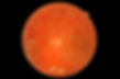 OCT eye scan.jpg