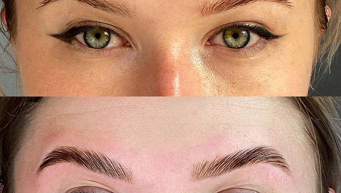 Brow Treatments