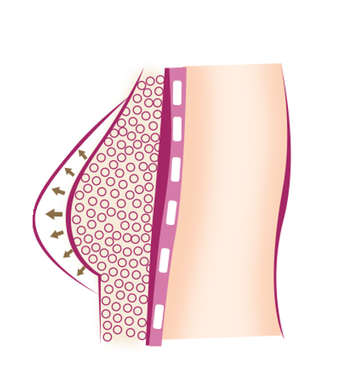 COVETTE-website-plastic-surgery-Breast-fat-grafting-diagram2.webp