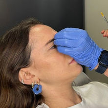 עשיתי בוטוקס בגיל 29 ופרסמתי את זה בסטורי