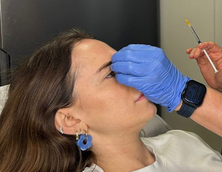 עשיתי בוטוקס בגיל 29 ופרסמתי את זה בסטורי