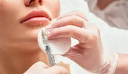 Perfilado de Labios