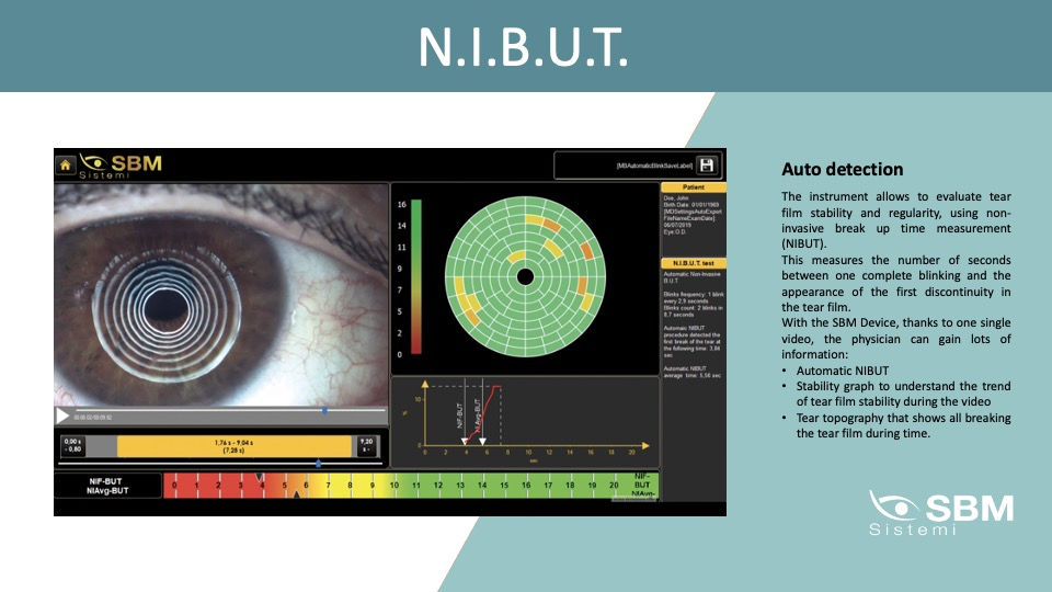 Thumbnail: SBM - idra (Dry eye Analysis)