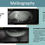 Thumbnail: SBM - idra (Dry eye Analysis)