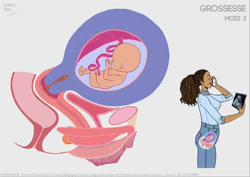 grossesse__numerique__fiches__3__fr.jpg
