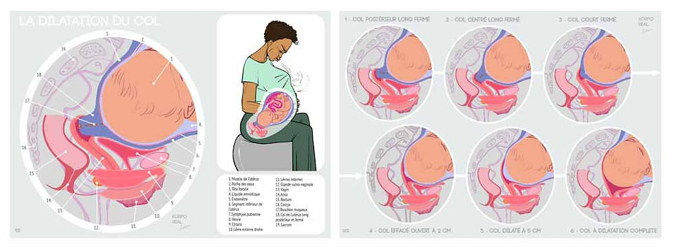Posters de dilatation du col, lot de 2 planches A2