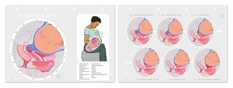 Fiches pédagogiques sur la dilatation du col, lot de 2 A4 perforées