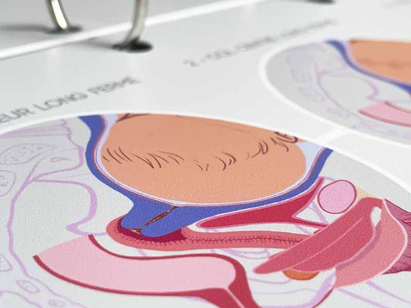 Zoom sur la deuxième fiche A4 illustrant les premiers centimètres de dilatation du col – visuel précis et contrasté sur support rigide perforé