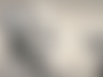 How Does Dementia Impact Independence and Daily Activities?