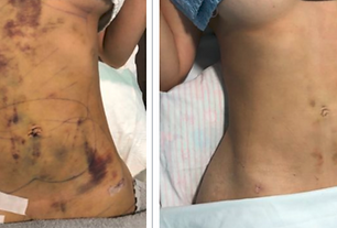 beforeand-after (2).png