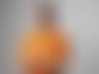 IMPACTO HISTÓRICO: Em apenas 3 meses, emenda impositiva do vereador Luiz Roberto Meneghetti reduz fila de ultrassom mamário em 67%