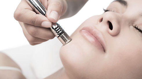 Copy of Microdermabrasion.jpeg