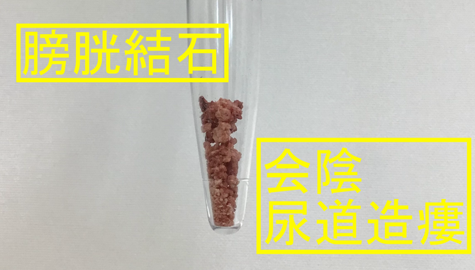会陰尿道造瘻