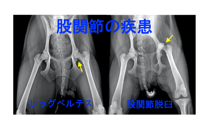 股関節の疾患