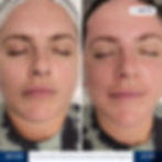 Zemits Coolrestore Elegance-3