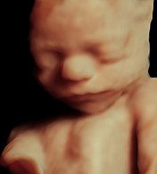 ultrasound