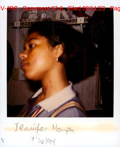 Jennifer Hough 1994 Poilce Photos Of Bruises After Kenneth Petty Sexual Assault