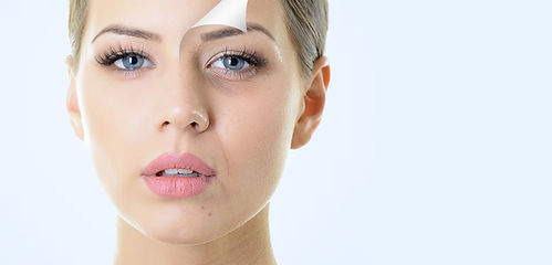 peelingi-medyczne-resurfacing-cosmelan-tca-fenolowy-ferulac-retiset-medycyna-estetyczna-laserowe-love-racibórz