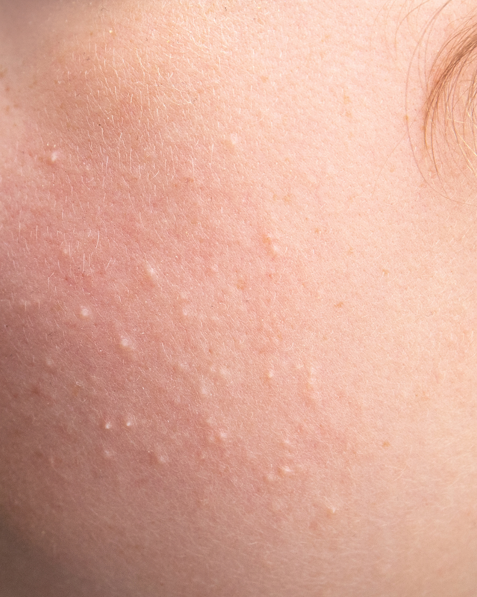 Neutral Minimalist Skincare Before and After Instagram Post (3).png