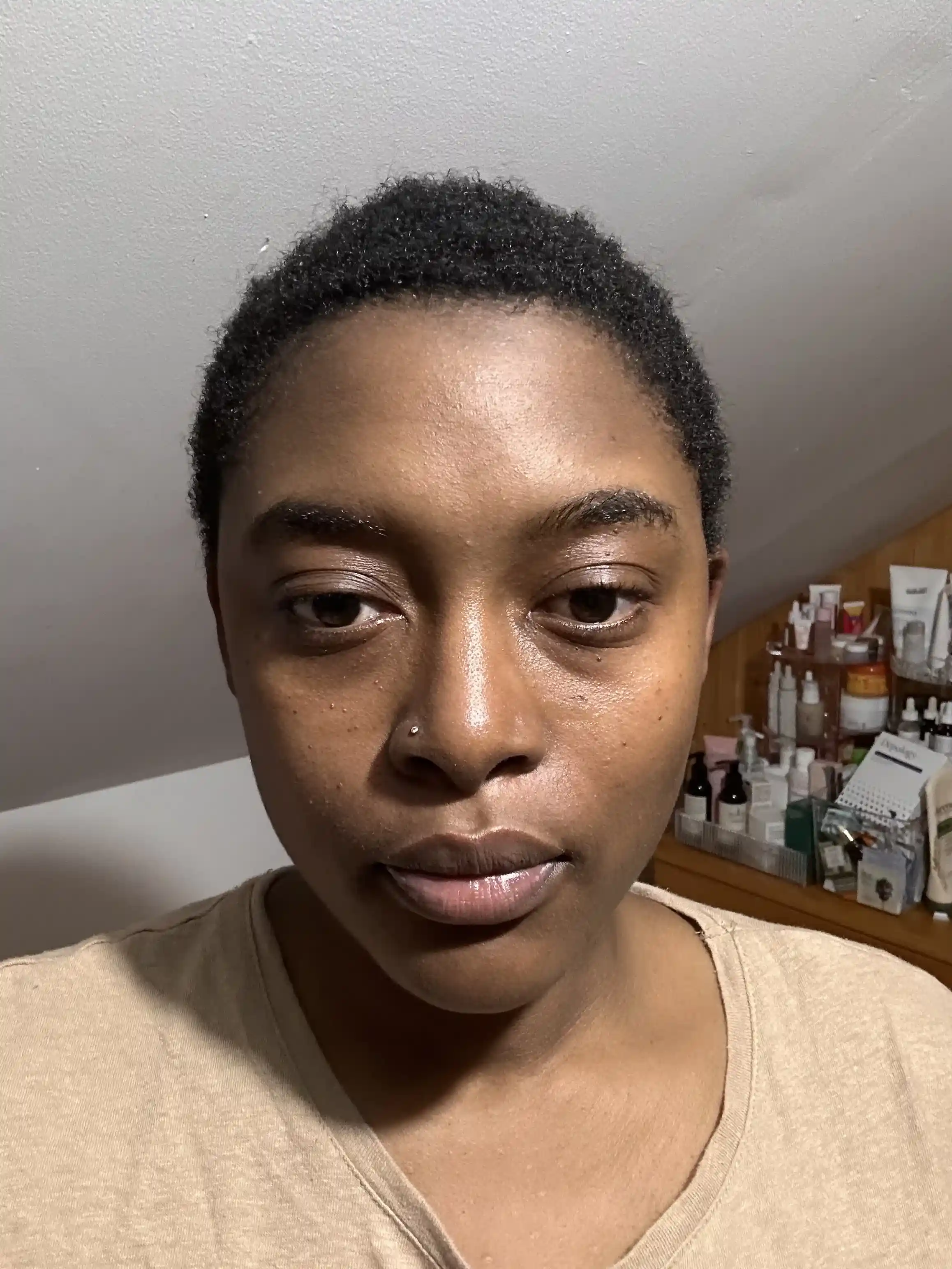 Habiba's face after having washed off the Depology Deepcare+ Serum-Infused Micro Dart Patches