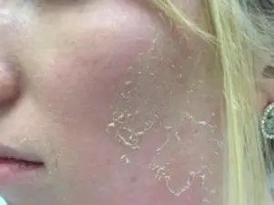 Retinol Peeling Skin (Causes, Healing Process & When To Stop)